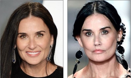 Mi történhetett Demi Moore arcával?