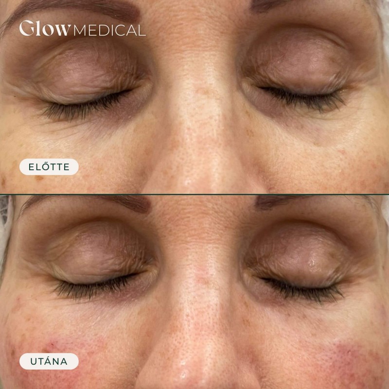 Glow Medical gallery