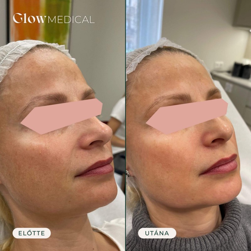 Glow Medical gallery