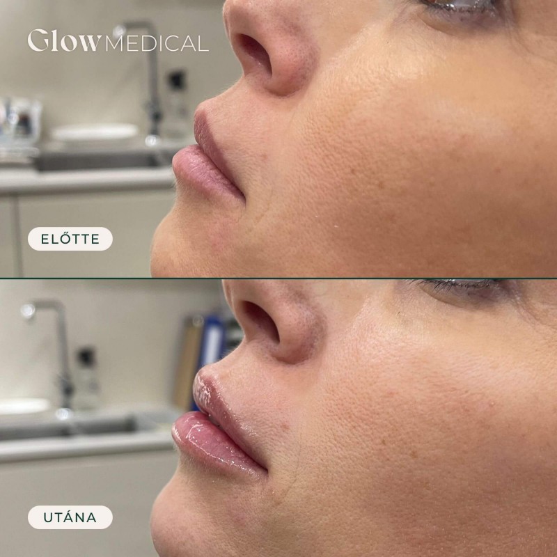 Glow Medical gallery